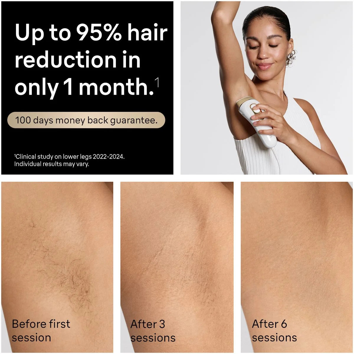Braun Smart IPL, Silk·Expert Pro 5: At Home Alternative to Laser Hair Removal with 2 Caps and Leather Pouch, IPL5137