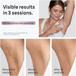 Braun IPL, Silk·Expert Mini, Permanent Laser Hair Reduction At-Home for Women and Men, IPL1111