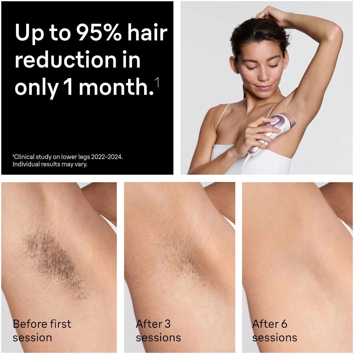 Braun Skin i·expert Smart IPL: At Home Alternative to Laser Hair Removal with 4 Caps and Vanity Case, PL7387