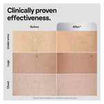 Braun Smart IPL, Silk·Expert Pro 5: At Home Alternative to Laser Hair Removal with Wide Cap and Leather Pouch, IPL5145