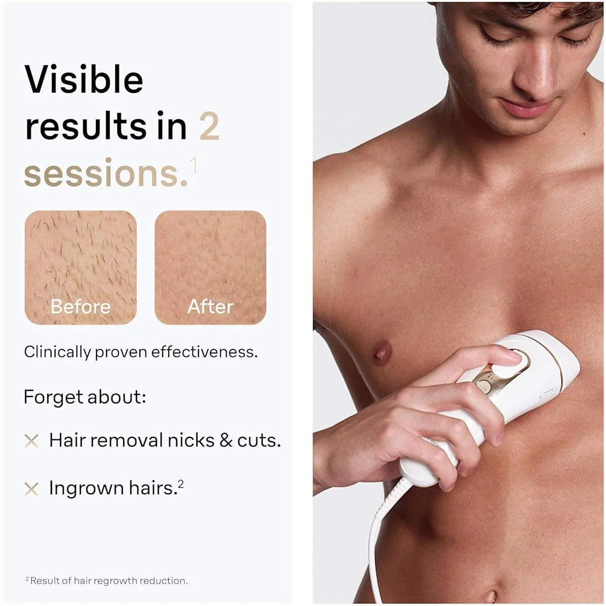 Braun Smart IPL, Silk·Expert Pro 5: At Home Alternative to Laser Hair Removal with Wide Cap and Leather Pouch, IPL5145