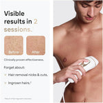 Braun Smart IPL, Silk·Expert Pro 5: At Home Alternative to Laser Hair Removal with Wide Cap and Leather Pouch, IPL5145